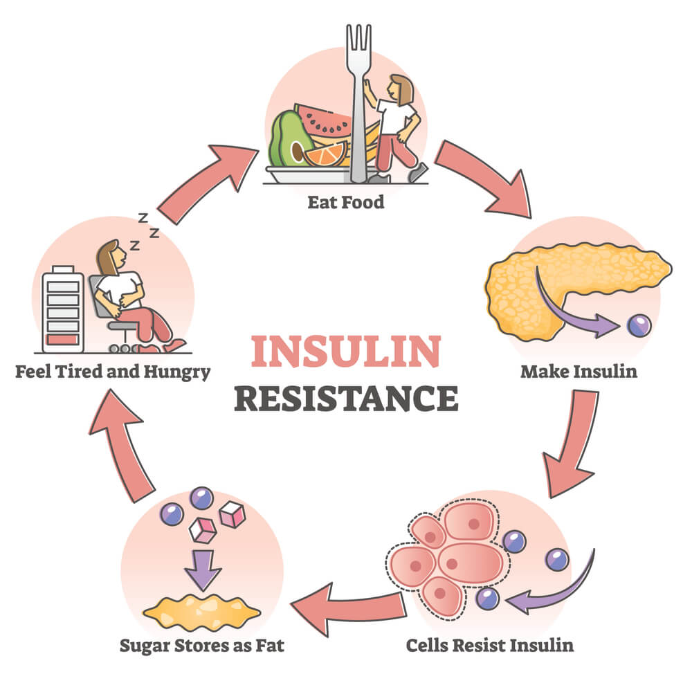 insulin-resistance-signs-causes-and-how-to-treat-naturally-dr